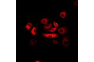 Immunofluorescent analysis of ATR staining in Hela cells.