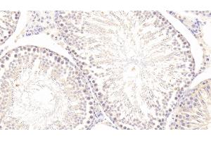 Detection of MMP1 in Rat Testis Tissue using Polyclonal Antibody to Matrix Metalloproteinase 1 (MMP1)
