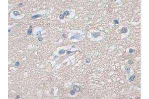 Detection of ERK1 in Human Cerebrum Tissue using Polyclonal Antibody to Extracellular Signal Regulated Kinase 1 (ERK1)