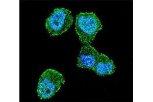 Confocal immunofluorescent analysis of LKB1 antibody with ZR-75-1 cells followed by Alexa Fluor 488-conjugated goat anti-rabbit lgG (green).