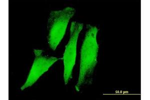 Immunofluorescence of monoclonal antibody to RNF11 on HeLa cell.