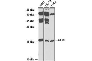 Western blot analysis of extracts of various cell lines, using GHRL antibody (ABIN3021900, ABIN3021901, ABIN3021902 and ABIN6217352) at 1:1000 dilution. (Ghrelin anticorps  (AA 1-117))