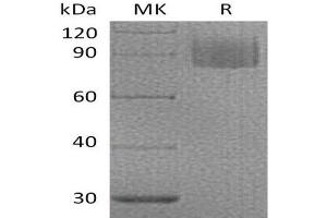 Western Blotting (WB) image for Myelin Associated Glycoprotein (MAG) protein (His tag) (ABIN7320800)