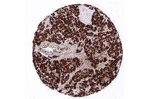 pancreas (CPA1 anticorps)