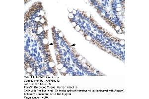 Human Intestine (ZNF12 anticorps  (N-Term))