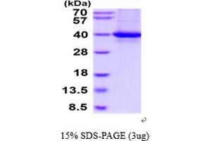 SDS-PAGE (SDS) image for Plasminogen Activator, Urokinase Receptor (PLAUR) (AA 23-305) protein (His tag) (ABIN5854660) (PLAUR Protein (AA 23-305) (His tag))