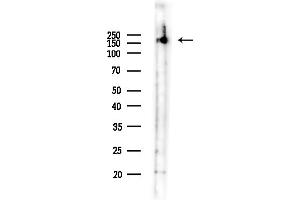 anti-ATP-Binding Cassette, Sub-Family C (CFTR/MRP), Member 6 (ABCC6) (Internal Region) antibody
