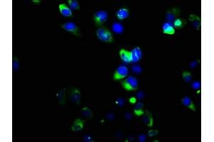 Immunofluorescence staining of Hela cells with ABIN7159444 at 1:133, counter-stained with DAPI. (Metabotropic Glutamate Receptor 6 anticorps  (AA 370-531))