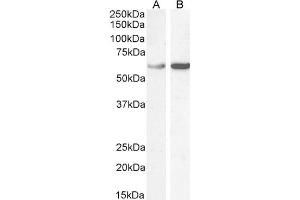 ABIN185185 (1µg/ml) staining of Human Ovary (A) lysate and HEK293 (B) cell lysate (35µg protein in RIPA buffer). (TCP1 alpha/CCTA anticorps  (C-Term))