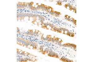 Immunohistochemistry of paraffin embedded rat small intestine using APOA4 (ABIN7073084) at dilution of 1:1200 (300x lens) (APOA4 anticorps)