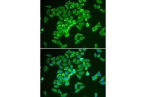 Immunofluorescence analysis of A549 cells using KEAP1 antibody.