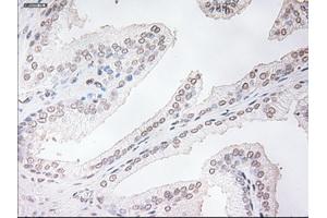 Immunohistochemical staining of paraffin-embedded prostate tissue using anti-TNNI3mouse monoclonal antibody. (TNNI3 anticorps  (AA 1-210))