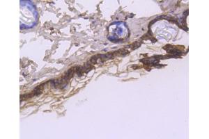 Paraformaldehyde-fixed, paraffin embedded rat spinal cord, Antigen retrieval by boiling in sodium citrate buffer (pH6) for 15min, Block endogenous peroxidase by 3% hydrogen peroxide for 30 minutes, Blocking buffer at 37°C for 20min, Antibody incubation with Cytokeratin 1 (1C2) Monoclonal Antibody  at 1:50 overnight at 4°C, followed by a conjugated secondary and DAB staining.