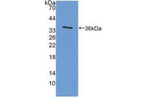 Western blot analysis of recombinant Rat IL4. (IL-4 anticorps  (AA 61-111))