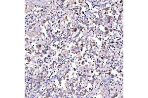 IHC analysis of SUCLG1 using anti-SUCLG1 antibody (ABIN7600906). (SUCLG1 anticorps  (AA 25-346))