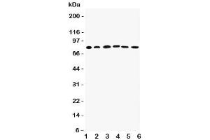 Western blot testing of Proprotein Convertase 1/3 antibody (Proprotein Convertase 1/3 (C-Term) anticorps)
