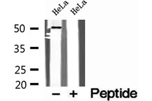 Western blot analysis of extracts of HeLa cells, using SNX17 antibody. (SNX17 anticorps  (N-Term))