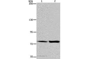 Western blot analysis of Hela and K562 cell, using GAB2 Polyclonal Antibody at dilution of 1:300 (GAB2 anticorps)