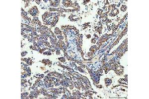 IHC analysis of TOMM20 using anti-TOMM20 antibody (ABIN7600883). (TOMM20 anticorps  (AA 25-145))