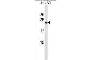 Western blot analysis in HL-60 cell line lysates (35ug/lane). (PCTP anticorps  (AA 59-87))