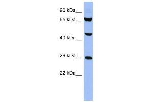 SNRPB antibody used at 1 ug/ml to detect target protein. (SNRPB anticorps  (N-Term))