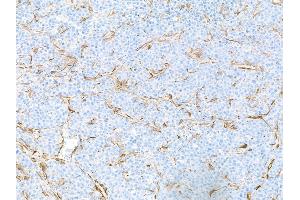 Immunohistochemistry (IHC) image for anti-Actin, alpha 2, Smooth Muscle, Aorta (ACTA2) (AA 1-50) antibody (ABIN7449438)