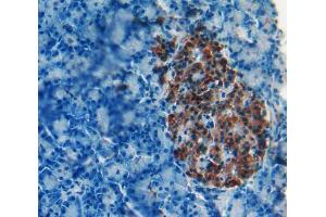IHC-P analysis of Kidney tissue, with DAB staining. (iPLA2 anticorps  (AA 481-702))