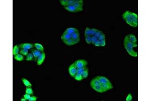 Immunofluorescent analysis of PC-3 cells using ABIN7152145 at dilution of 1:100 and Alexa Fluor 488-congugated AffiniPure Goat Anti-Rabbit IgG(H+L)