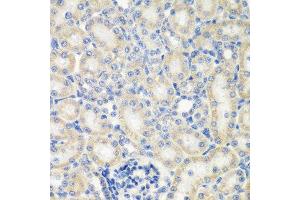 Immunohistochemistry of paraffin-embedded rat kidney using NAA50 antibody. (NAA50 anticorps  (AA 1-169))