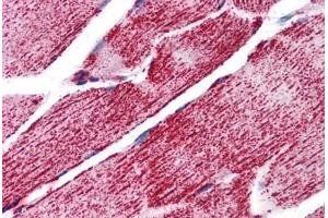 Human Skeletal Muscle: Formalin-Fixed, Paraffin-Embedded (FFPE) (HSPA9 anticorps  (C-Term))