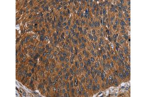 Immunohistochemistry (IHC) image for anti-Fc Fragment of IgG, Low Affinity IIIa, Receptor (CD16a) (FCGR3A) antibody (ABIN2430290) (FCGR3A anticorps)