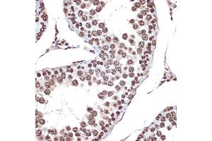 Immunohistochemistry of paraffin-embedded rat testis using HMGB2 Rabbit mAb (ABIN7267649) at dilution of 1:100 (40x lens). (HMGB2 anticorps)