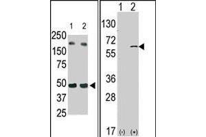 (LEFT) The SPHK1 polyclonal antibody  is used in Western blot (Lane 2) to detect c-myc-tagged SPHK1 in transfected 293 cell lysate (ac-myc antibody is used as control in Lane 1).