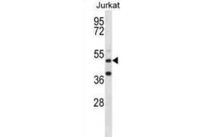Western Blotting (WB) image for anti-RNA Binding Motif Protein 22 (RBM22) antibody (ABIN2998337) (RBM22 anticorps)