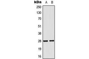 Western blot analysis of NKX2-6 expression in MCF7 (A), COLO205 (B) whole cell lysates. (NKX2-6 anticorps  (Center))