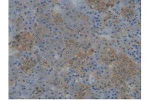 Detection of CYP17A1 in Rat Adrenal gland Tissue using Polyclonal Antibody to Cytochrome P450 17A1 (CYP17A1)