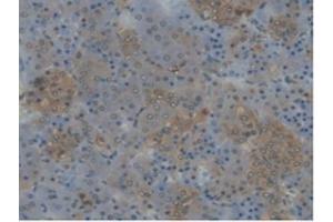 Detection of CYP17A1 in Rat Adrenal gland Tissue using Polyclonal Antibody to Cytochrome P450 17A1 (CYP17A1) (CYP17A1 anticorps  (AA 201-507))