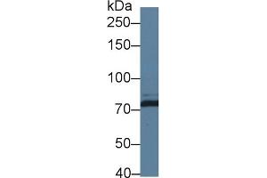 Detection of DICER1 in Human HepG2 cell lysate using Polyclonal Antibody to Dicer 1, Ribonuclease Type III (DICER1)