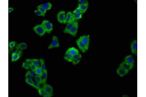 Immunofluorescence staining of HepG2 cells with ABIN7169782 at 1:66, counter-stained with DAPI. (SLAMF6 anticorps  (AA 248-331))