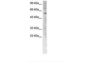 Image no. 3 for anti-Zinc Finger Protein 500 (ZNF500) (AA 348-397) antibody (ABIN6735775) (ZNF500 anticorps  (AA 348-397))