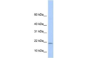 POLR1D antibody used at 1 ug/ml to detect target protein. (POLR1D anticorps)