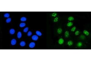 IF analysis of DHODH using anti-DHODH antibody (ABIN7603140). (DHODH anticorps  (N-Term))
