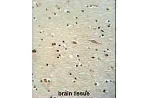 MSTR antibody (N-term) (ABIN654568 and ABIN2844273) immunohistochemistry analysis in forlin fixed and paraffin embedded hun brain tissue followed by peroxidase conjugation of the secondary antibody and DAB staining.