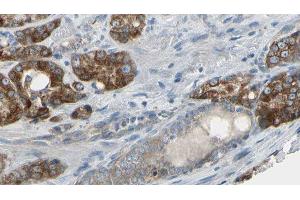 ABIN6279443 at 1/100 staining Human prostate tissue by IHC-P. (Gephyrin anticorps  (Internal Region))