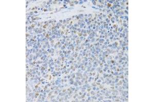 Immunohistochemistry of paraffin-embedded rat spleen using SFN Antibody. (14-3-3 sigma/SFN anticorps  (AA 1-248))