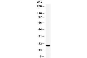 Western blot testing of human K562 cell lysate with APRT antibody at 0.