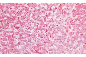 Detection of GAS6 in Human Liver Tissue using Polyclonal Antibody to Growth Arrest Specific Protein 6 (GAS6)