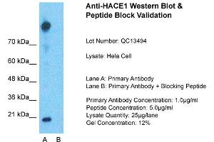 Host: Rabbit  Target Name: HACE1  Sample Tissue: Hela Whole cell  Lane A:  Primary Antibody Lane B: Primary Antibody + Blocking Peptide Primary Antibody Concentration: 1 µg/mL Peptide Concentration: 5 µg/mL Lysate Quantity: 41 µg/lane/LaneGel Concentration:. (HACE1 anticorps  (Middle Region))