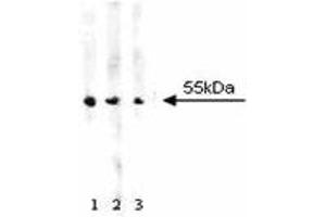 Western blot analysis of ALDH on A431 cell lysate. (Aldehyde Dehydrogenase anticorps  (AA 7-128))