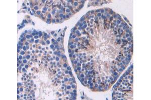 Used in DAB staining on fromalin fixed paraffin- embedded testis tissue (ABCC11 anticorps  (AA 1127-1366))